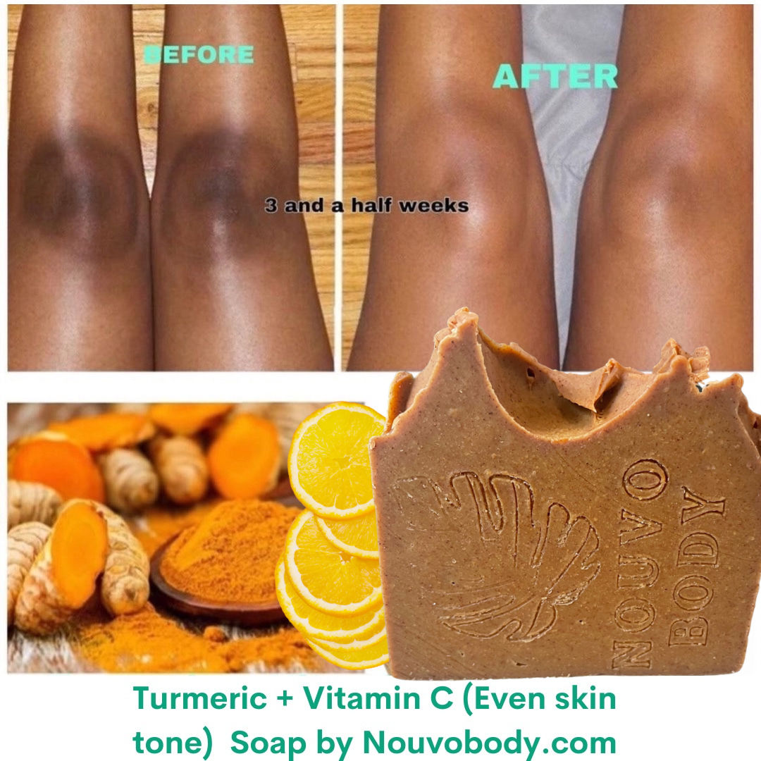 Turmeric + Vitamin C (Even skin tone)- 1 Bar Soap