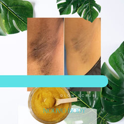 Ingrown Hairs & Strawberry Skin Solution