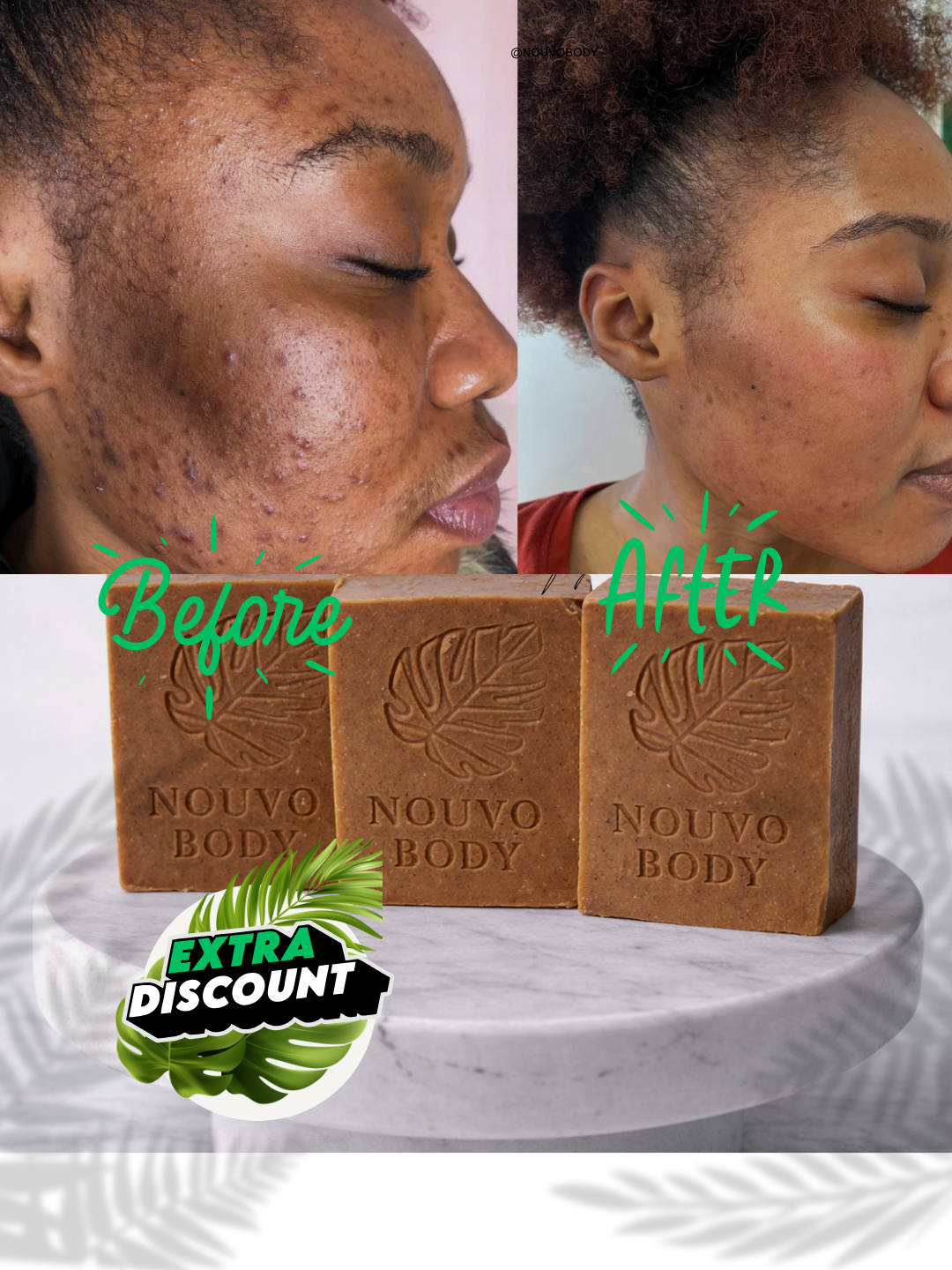 Turmeric + Vitamin C Even skin tone Bar Soaps - - 3 thick Bars