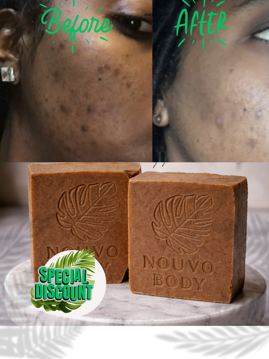 Turmeric + Vitamin C Even skin tone Bar Soaps - - 2 thick Bars